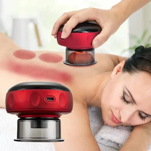 Electric Cupping Therapy | Wellness Gadget — wholesale Kitchen & Drinkware by the case