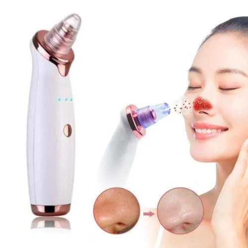 Blackhead Remover Skincare Tool | Tech Beauty — wholesale Beauty & Personal Care by the case